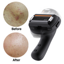Senshave Full Body Razor — Starter Kit